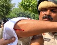 दिल्ली में CJP प्रदर्शन: करीब 2000 हिरासत में, केजरीवाल-ममता पर भी कार्रवाई; कनॉट प्लेस में पथराव